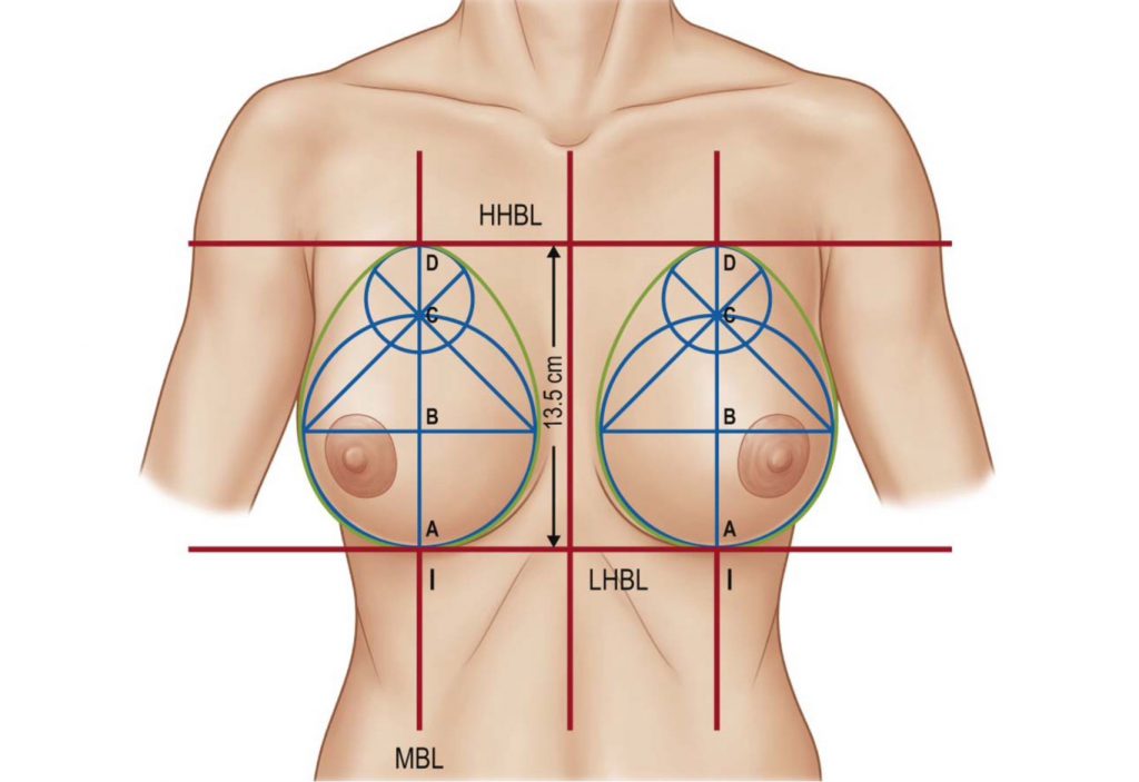 Ideal Breast