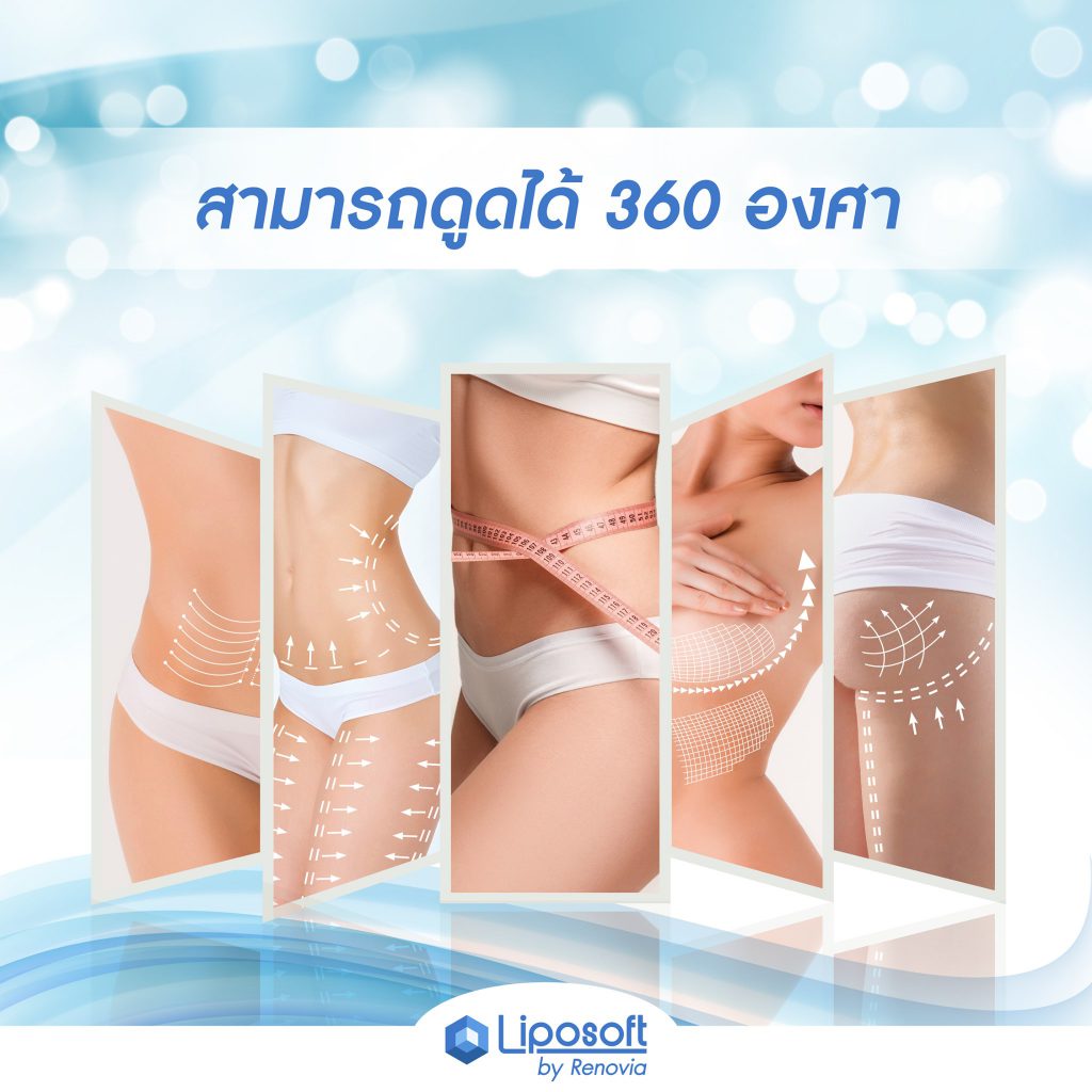 S-Curve 360 degree