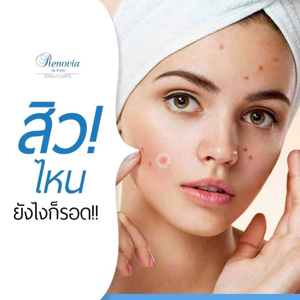 acne pro 9